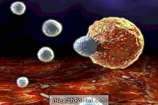 Hiểu được u lympho T angioimmunoablastic