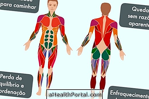 Beckeras muskuļu distrofija ir ģenētiska slimība, kas pakāpeniski iznīcina vairākus brīvprātīgos muskuļus, tas ir, muskuļus, kurus mēs varam kontrolēt, piemēram, piemēram, gūžas, plecu, kāju vai rokas. Tas parasti ir biežāk sastopams vīriešiem, un pirmie simptomi parādās bērnībā vai pusaudžiem, sākot ar nelielu un pakāpenisku spēka zaudēšanu gandrīz visos ķermeņa muskuļos, bet it īpaši pleciem un gūžām. Lai gan šai slimībai nav zāles, ir iespēj