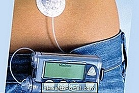 Insulin pump