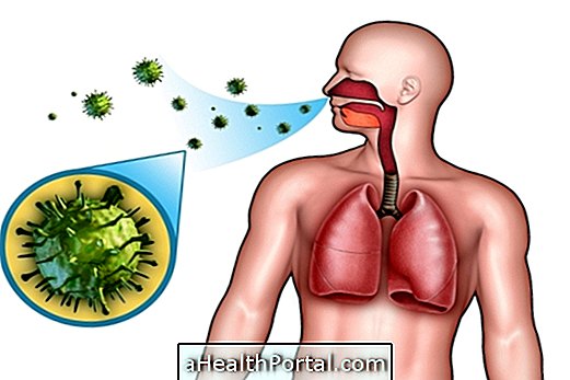 Meningitis viral menular - Ketahui cara melindungi diri sendiri