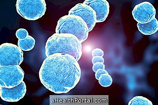 Τι είναι η λοίμωξη από Streptococcus, τα κύρια είδη και τον τρόπο ταυτοποίησης