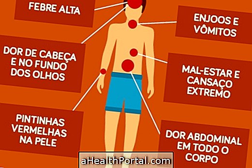 Gejala-gejala yang disebabkan oleh Denggi