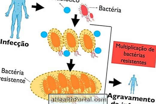 Tā kā antibiotiku pārmērīga lietošana var būt bīstama