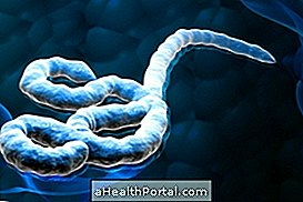 Ebola-virus