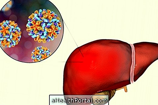 Alles über Hepatitis E