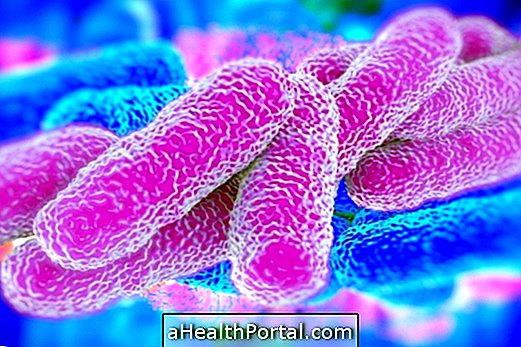 Penggunaan antibiotik yang tidak tepat menimbulkan Superbacteria