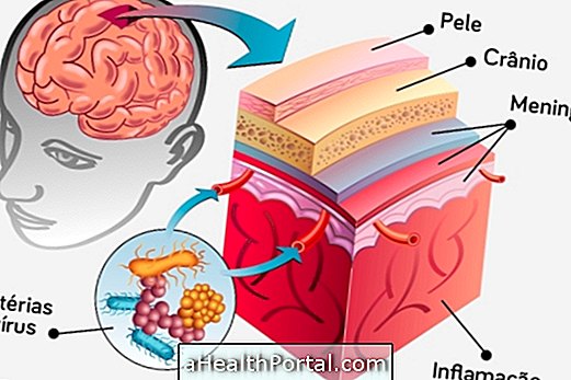 Memahami meningitis dan bagaimana melindungi diri anda