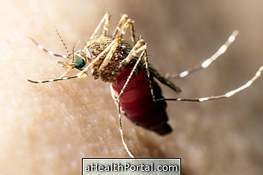 Malaria: Gejala, Penghantaran, Rawatan dan Cara Mencegah