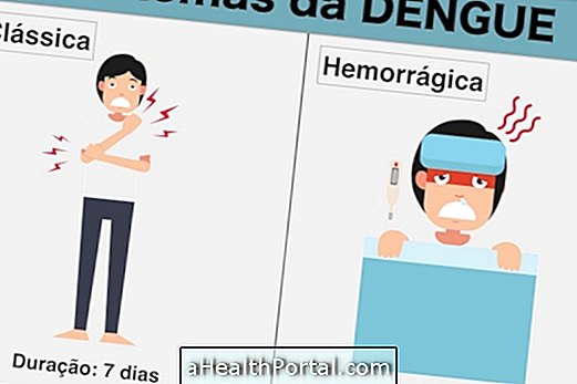 Quanti giorni durano i sintomi della dengue?