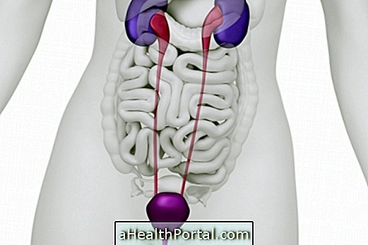 Apa itu Cystitis, apa saja gejala, penyebab dan pengobatannya