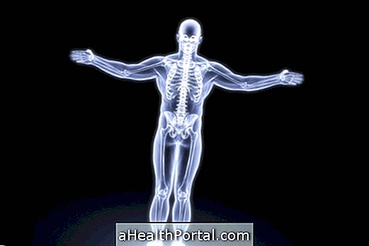 Tuberculosis in Bones