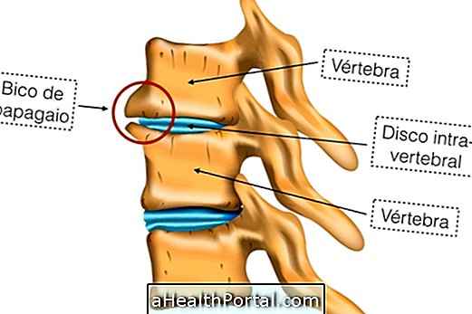 Các triệu chứng và điều trị cho núm vú vẹt