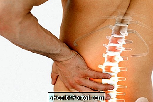 Cara Mengenalpasti dan Mengobati Spondyloarthrosis Lumbar