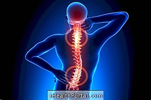 Spondylosis dan Spondylolisthesis: Apa yang mereka dan Bagaimana untuk merawat