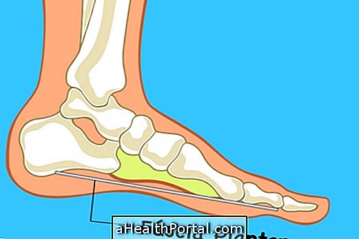 Hvad er plantar fasciitis og hvordan man behandler det