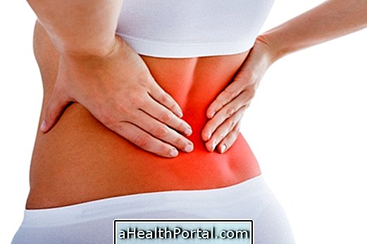 Bagaimana Mengidentifikasi dan Mengobati Hyperlordosis di Spine