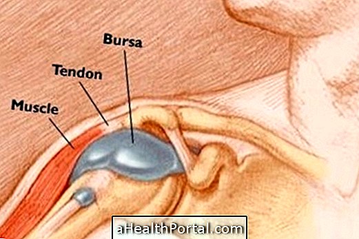 Apakah perbezaan antara tendinitis dan bursitis?