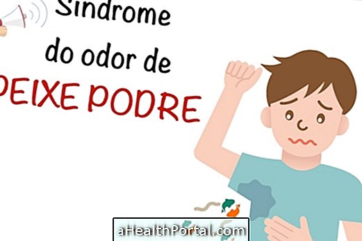 L'odore di pesce povero nel corpo può essere la Sindrome