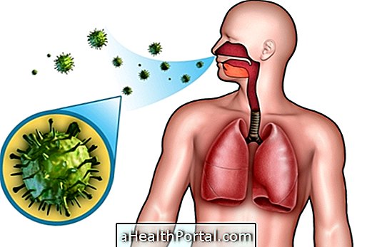 Community Pneumonia: What It Is, Symptoms and Treatment