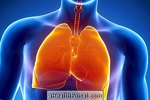 Pneumonitis: apa itu, jenis, gejala dan bagaimana perawatan dilakukan