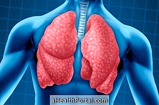 What is Pleurisy and Main Symptoms