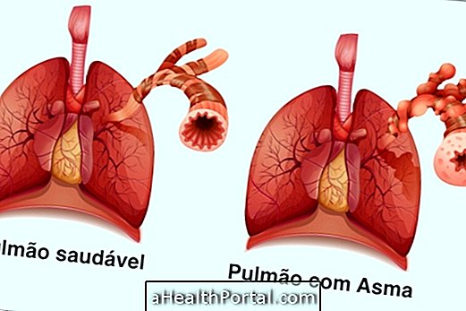 Понять астму