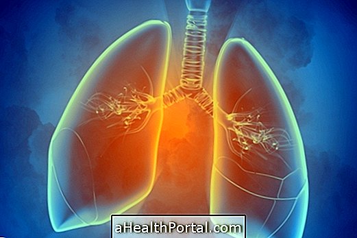 Apa itu Pulmonary Scintigraphy dan untuk apa itu?