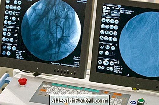 Bagaimanakah angiography dilakukan dan apakah itu?