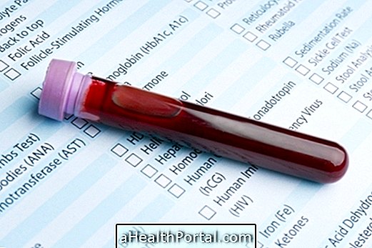 Qu'est-ce que le test à l'estradiol et à quoi sert-il?