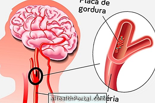 ما هو الموجات فوق الصوتية السباتي المستخدمة؟