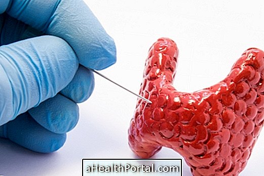 الغدة الدرقية لكمة: ما هو عليه وكيف نفهم النتيجة