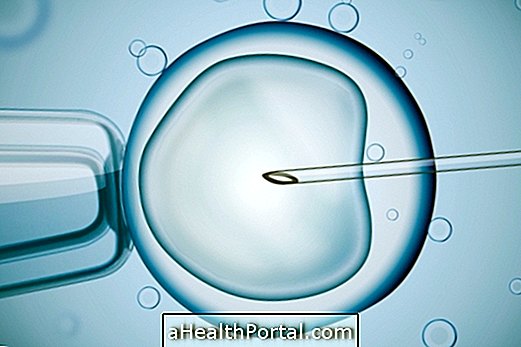 ovules แช่แข็งเป็นตัวเลือกในการตั้งครรภ์เมื่อคุณต้องการ