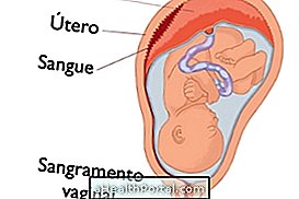 Waar is de placenta voor en wat kan er gebeuren als het wordt veranderd