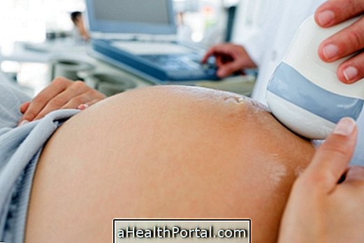 What is the Fetal Biophysical Profile and how is it done?