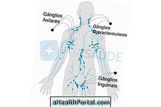 Lymphatic drainage a terhességben