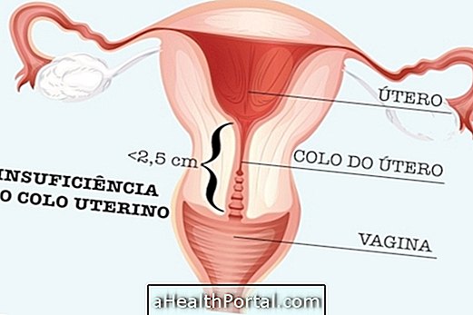 Kaip atsigauti po operacijos, kad kūdikis būtų laikomas gimdoje?