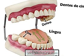 Cara menyikat gigi agar Anda tidak memiliki gigi berlubang dan bau mulut