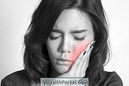 Dental Abscess: Penyebab, Gejala dan Pengobatan