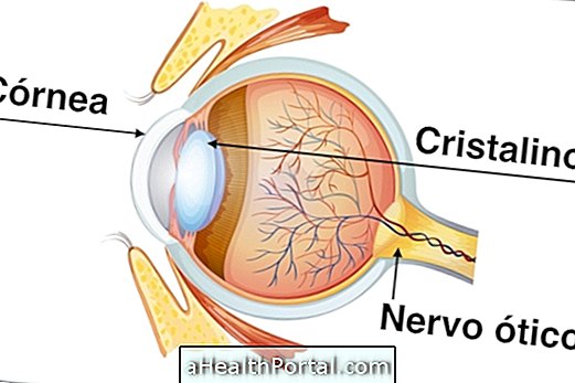 Hoe verloopt het herstel van Corneal Transplant?