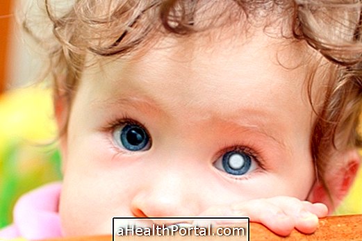 How to Identify and Treat Retinoblastoma