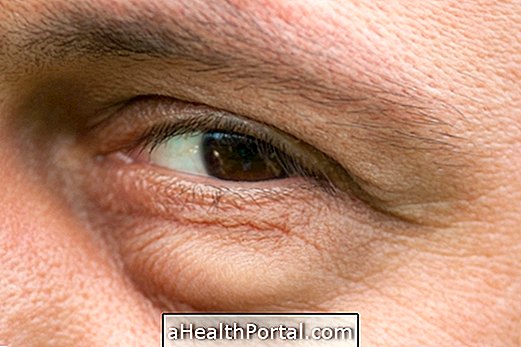 Swollen eyes: What can be and how to treat