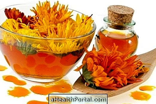 Marigold Burns için sıkıştır