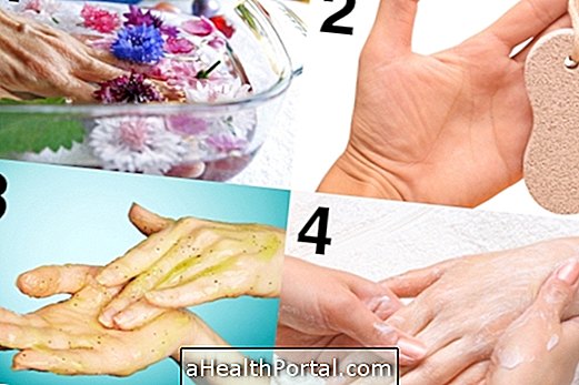 4 Steps to Remove Calluses from Hands