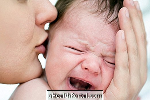 How to treat baby with Cytomegalovirus