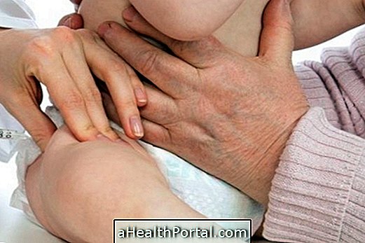 Botox dapat membantu dalam perawatan bayi dengan Microcephaly