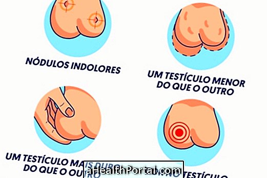 Top 5 sintomi di cancro testicolare e come trattarlo