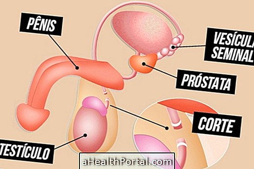 7 soalan yang paling biasa mengenai vasektomi