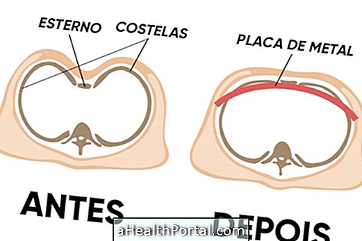 発掘された乳を修正する方法