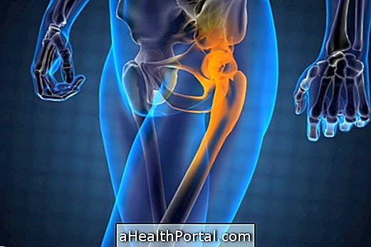 Hip Pain - Penyebab dan Perawatan Umum