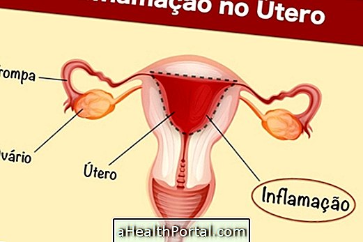 Infektioiden oireet kohdussa